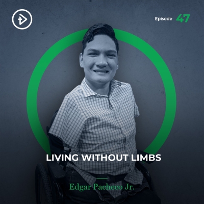 #47 Living Without Limbs (tetra-amelia syndrome) - Edgar Pacheco Jr.